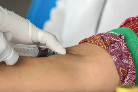 Pobieranie krwi strzykawką z żyły na ramieniu.