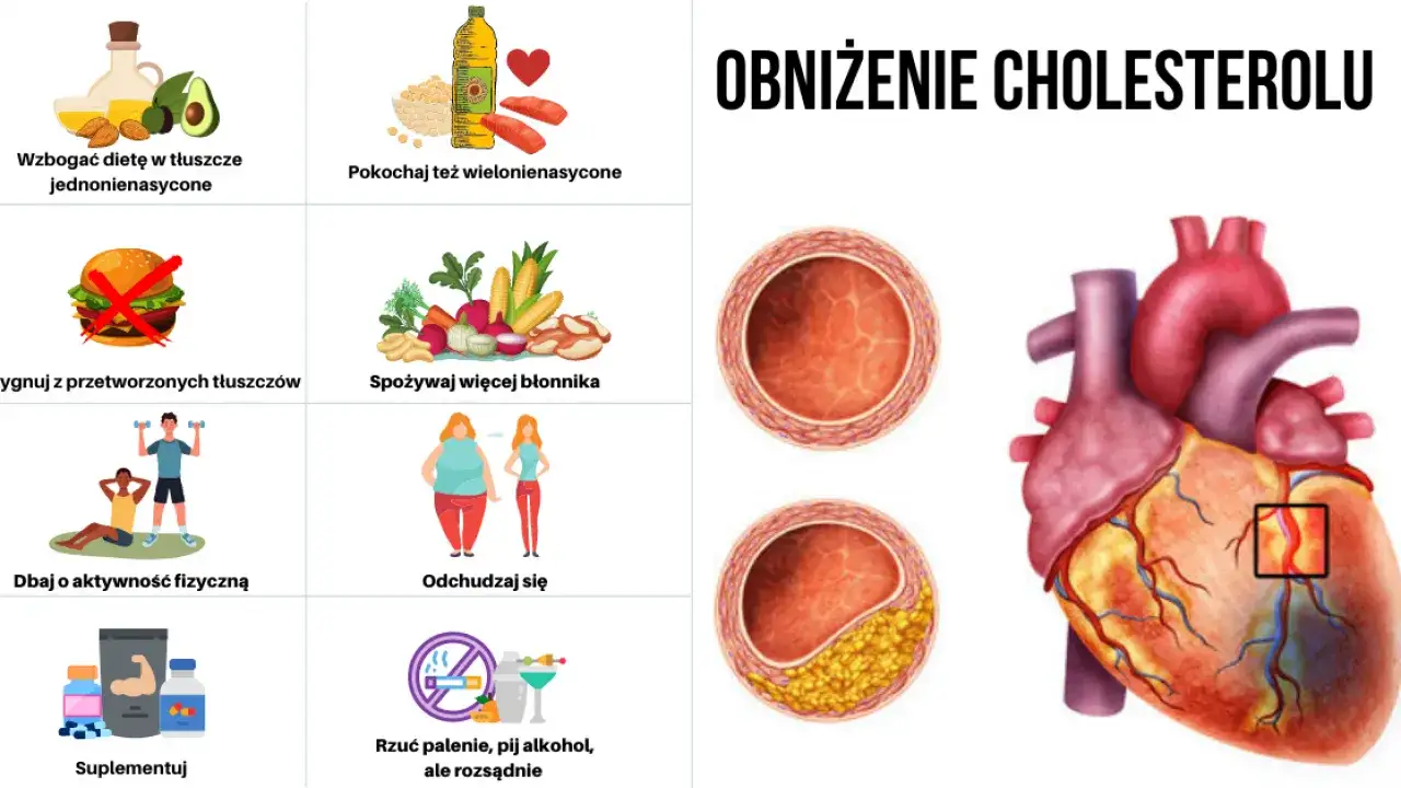 aktywność fizyczna obniżanie cholesterolu